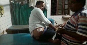 Bhatpara: ভাটপাড়ায় তৃণমূল নেতাকে গুলির ঘটনায় অভিযুক্তরা অধরা  